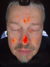 система зеркала умной цифровой фотокамеры анализа блока развертки кожи 3Д волшебная для продажи