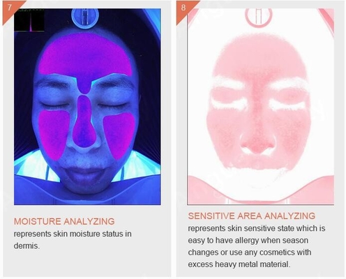 Викторины машины 3D анализатора кожи угорь пигментацией морщинки Skincare умные