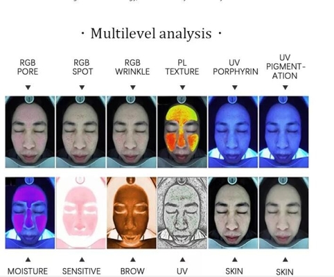 Камера анализатора 15MP кожи УЛЬТРАФИОЛЕТОВОГО PL андроида RGB профессиональная лицевая