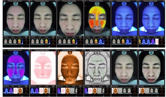 Анализатор кожи RGB УЛЬТРАФИОЛЕТОВЫЙ PL умный