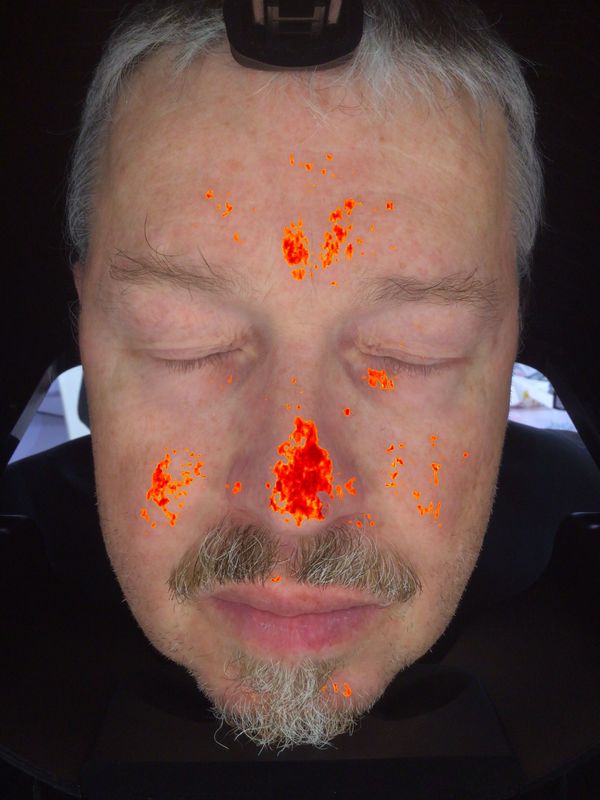 система зеркала умной цифровой фотокамеры анализа блока развертки кожи 3Д волшебная для продажи